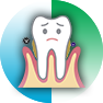 Periodontal Surgery